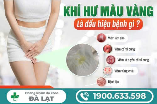 Hình ảnh minh họa